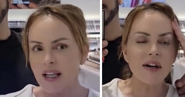 Gaby Spanic impacta con su nueva imagen tras tratamiento estético