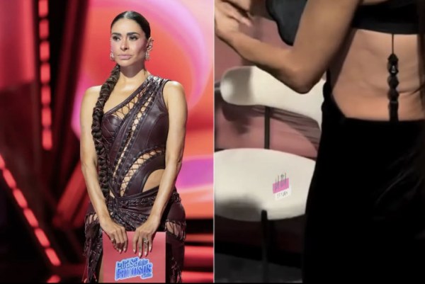 Galilea Montijo desata especulaciones por lesión en la espalda