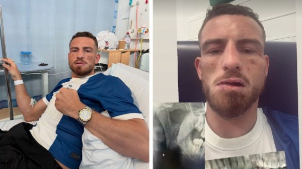 Peleador sufre fractura de mandíbula tras cabezazo de rival