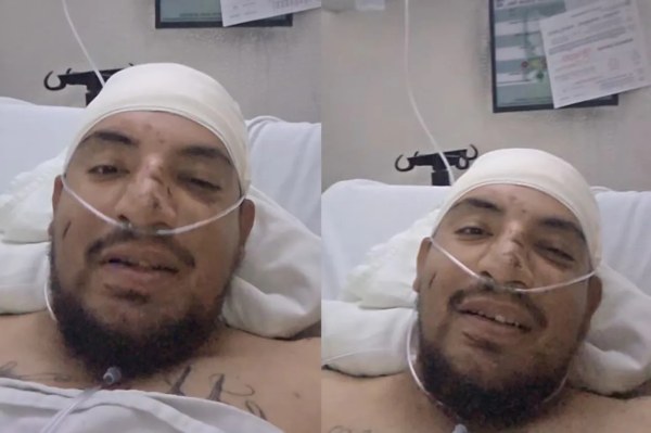 Se recupera chofer afectado por camionazo