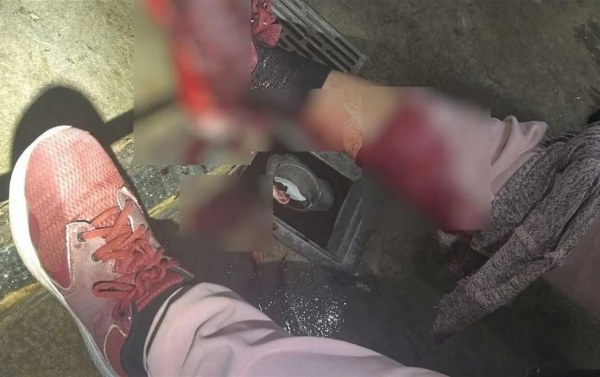 Perro brinca reja de su casa y ataca a mujer que caminaba