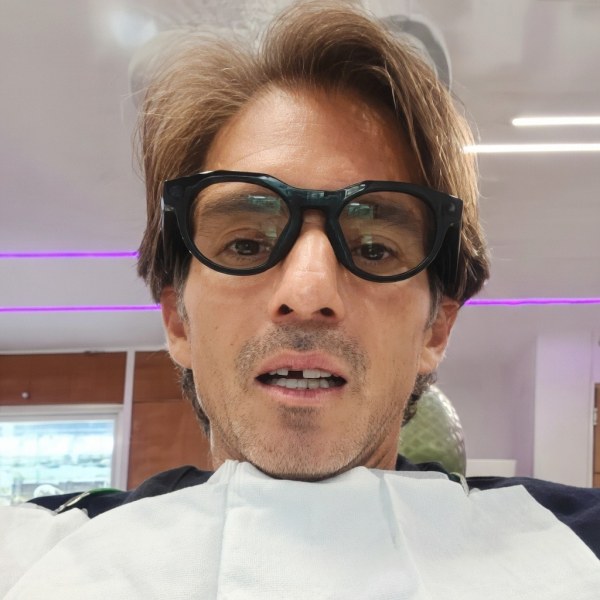 ¡Slam-dentado! A Fernando Reyna le vuelan el diente en pleno concierto