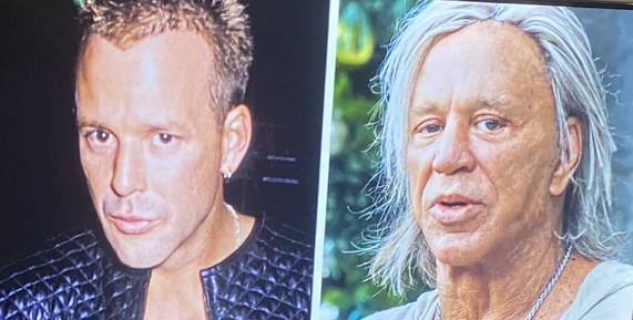 Galería: El Precio de la Perfección: Estrellas de Hollywood que Transformaron su rostro radicalmente