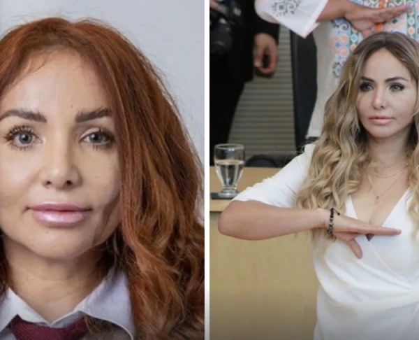 Diputada de Morena factura cirugías plásticas al Congreso