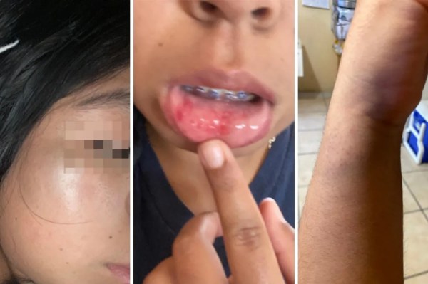 Denuncia joven violento asalto en UACJ