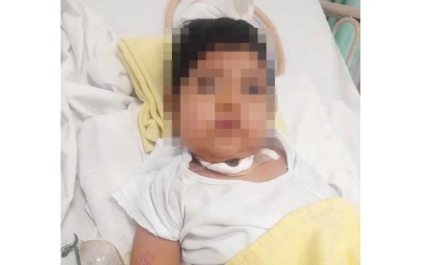 Piden apoyo para niño de 3 años que necesita aspirador eléctrico